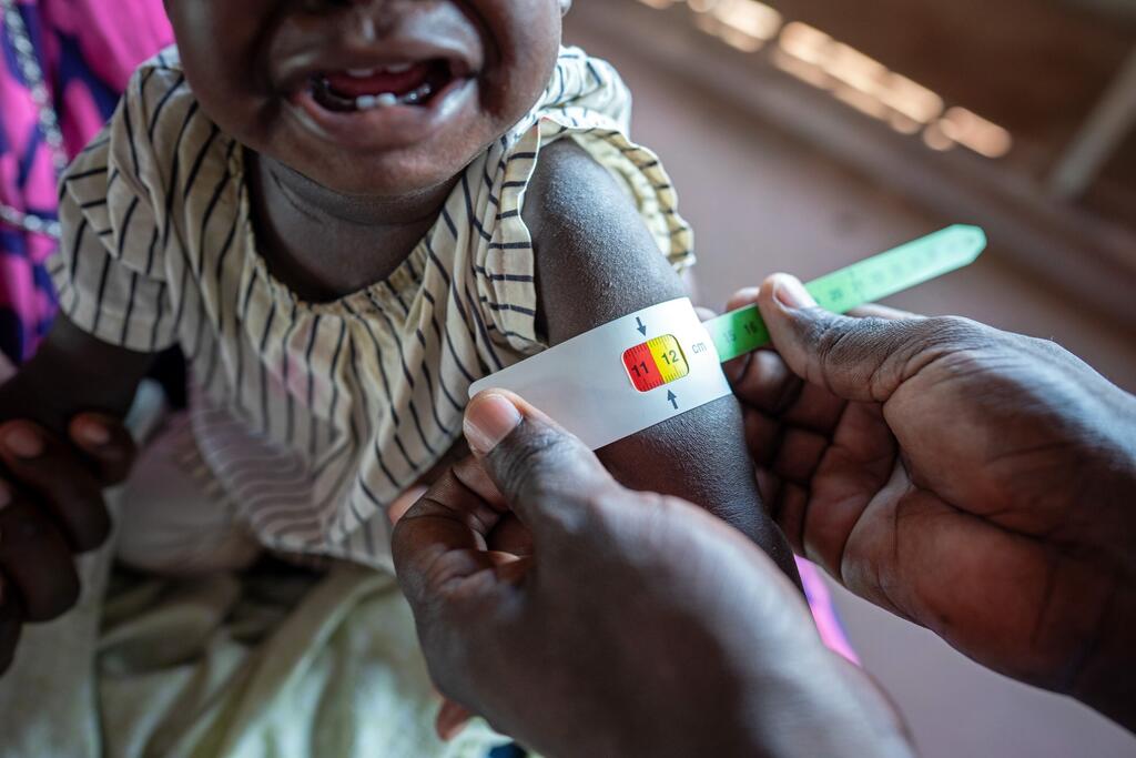 Медицинский работник измеряет окружность руки ребенка: так определяется уровень истощения.